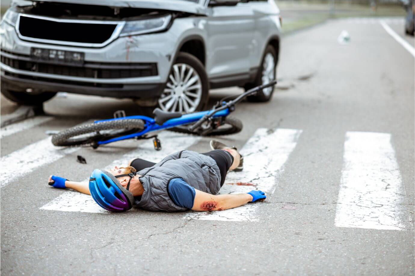 Visual depiction of a man lying on the street, highlighting the expertise of Gurvis Personal Injury Lawyers in cases related to pedestrian accidents. The image aligns with the context of the page, emphasizing the firm's dedication to addressing such incidents.